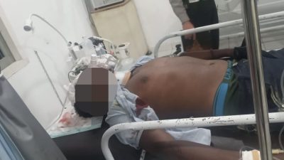 Karena Pengaruh Miras Pengendara Sepeda Motor Tabrak Pembatas Jalan di Holtekamp